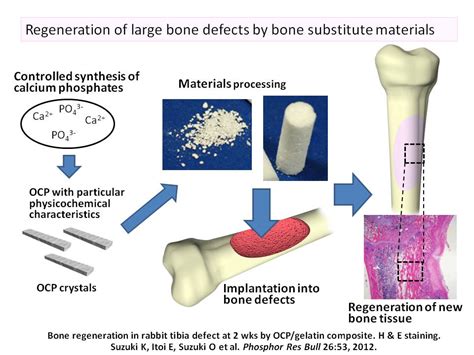 Osteoconductive Ceramic-Hydroxyapatite: Unlocking Bone Regeneration Possibilities in Advanced Medical Implants!